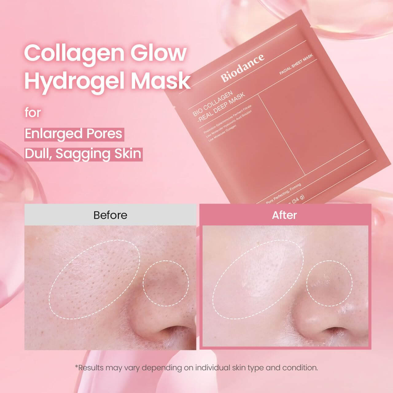 BIODANCE Bio-Collagen Hydrogel Mask – Hydrating & Pore Minimizing Overnight Face Mask, 4 Pack (1.19 oz each)