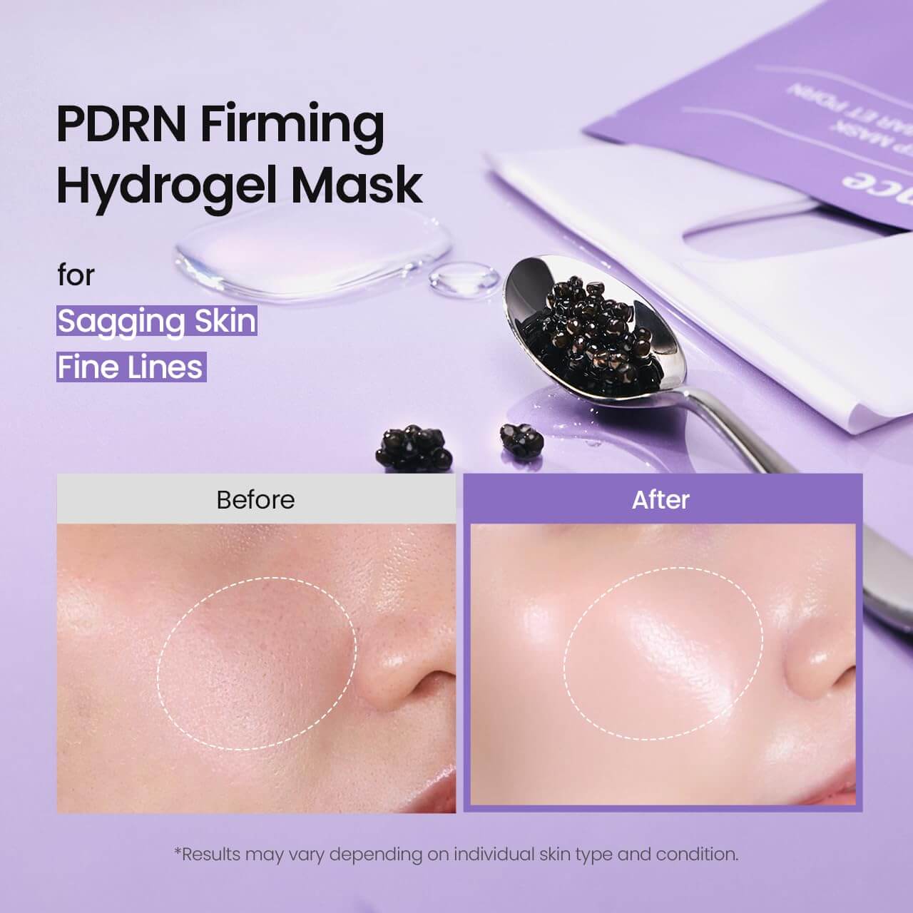 BIODANCE Caviar PDRN Hydrogel Mask – Firming & Radiance Overnight Face Mask, 4 Pack (1.19 oz each)
