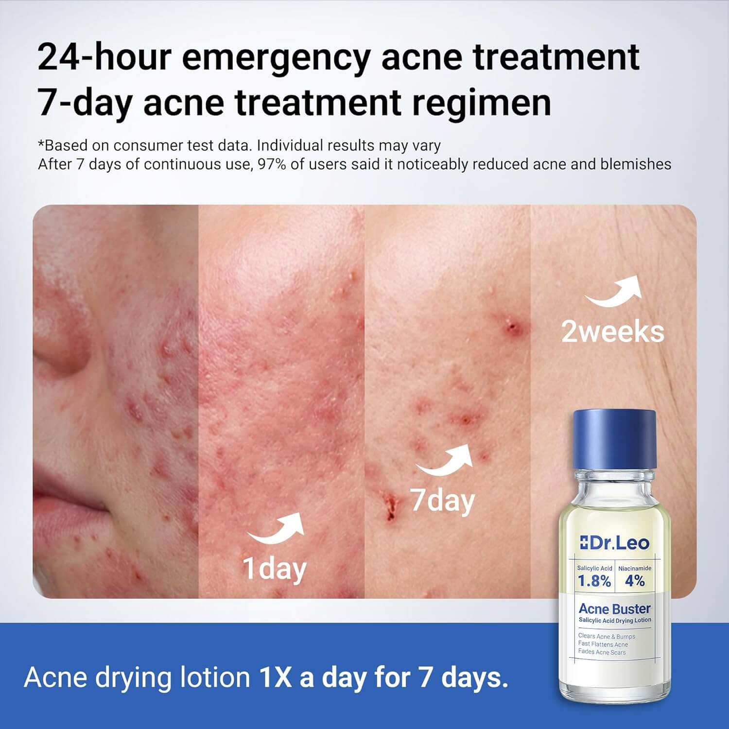 Dr. Leo Salicylic Acid Spot Serum – Acne Treatment with Niacinamide, 0.34 fl oz