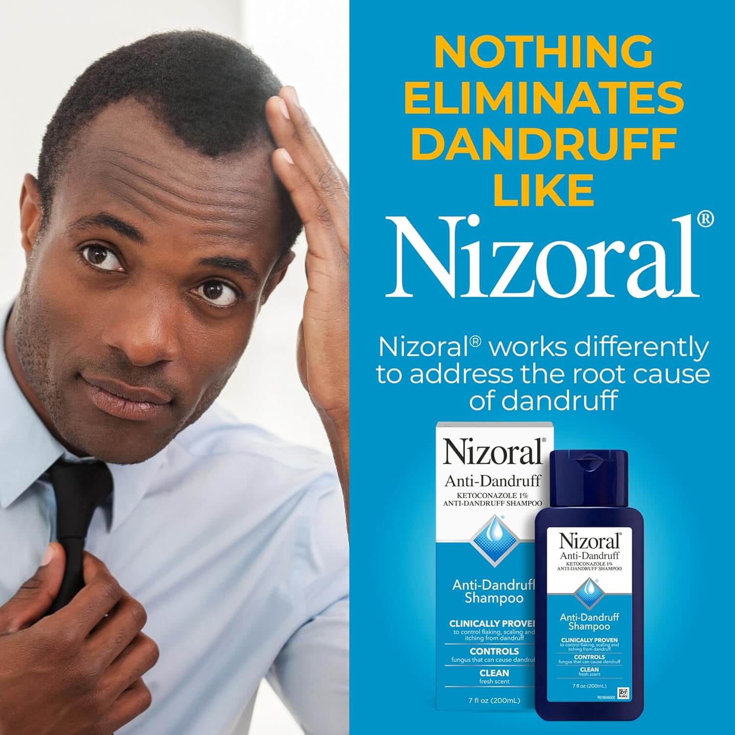 Nizoral Anti-Dandruff Shampoo – 1% Ketoconazole Scalp Treatment Shampoo, 7 fl oz