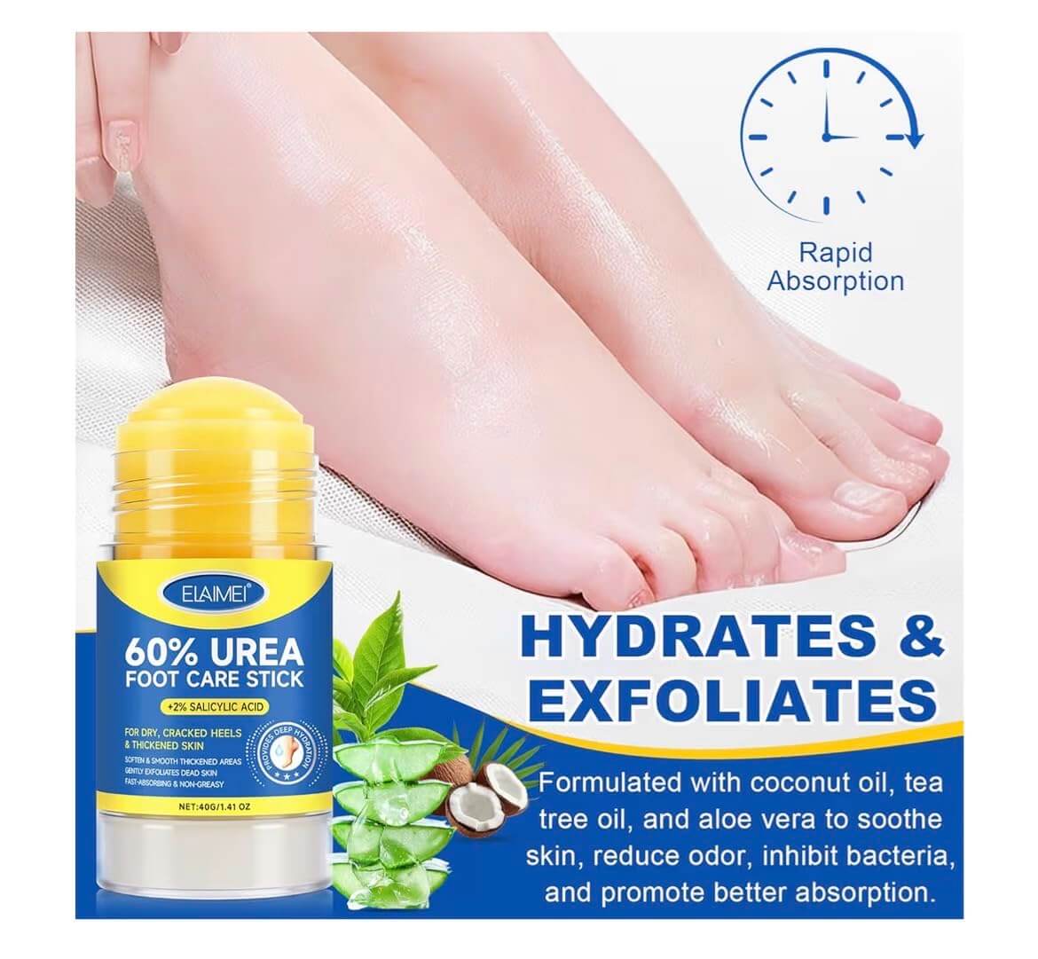 Salicylic Acid Foot Cream – Exfoliating & Hydrating Callus Repair Moisturizer, 3.38 fl oz