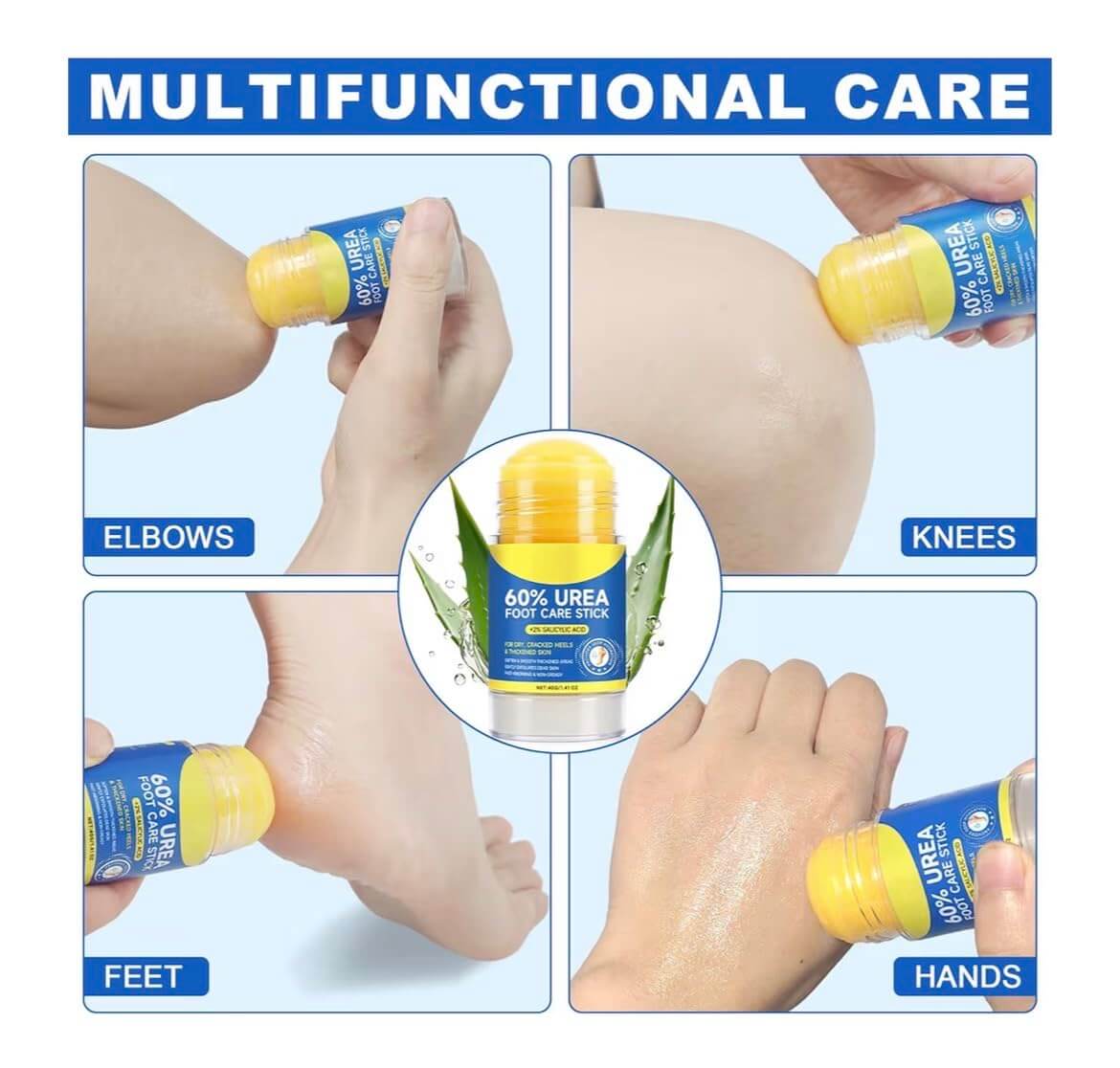 Salicylic Acid Foot Cream – Exfoliating & Hydrating Callus Repair Moisturizer, 3.38 fl oz