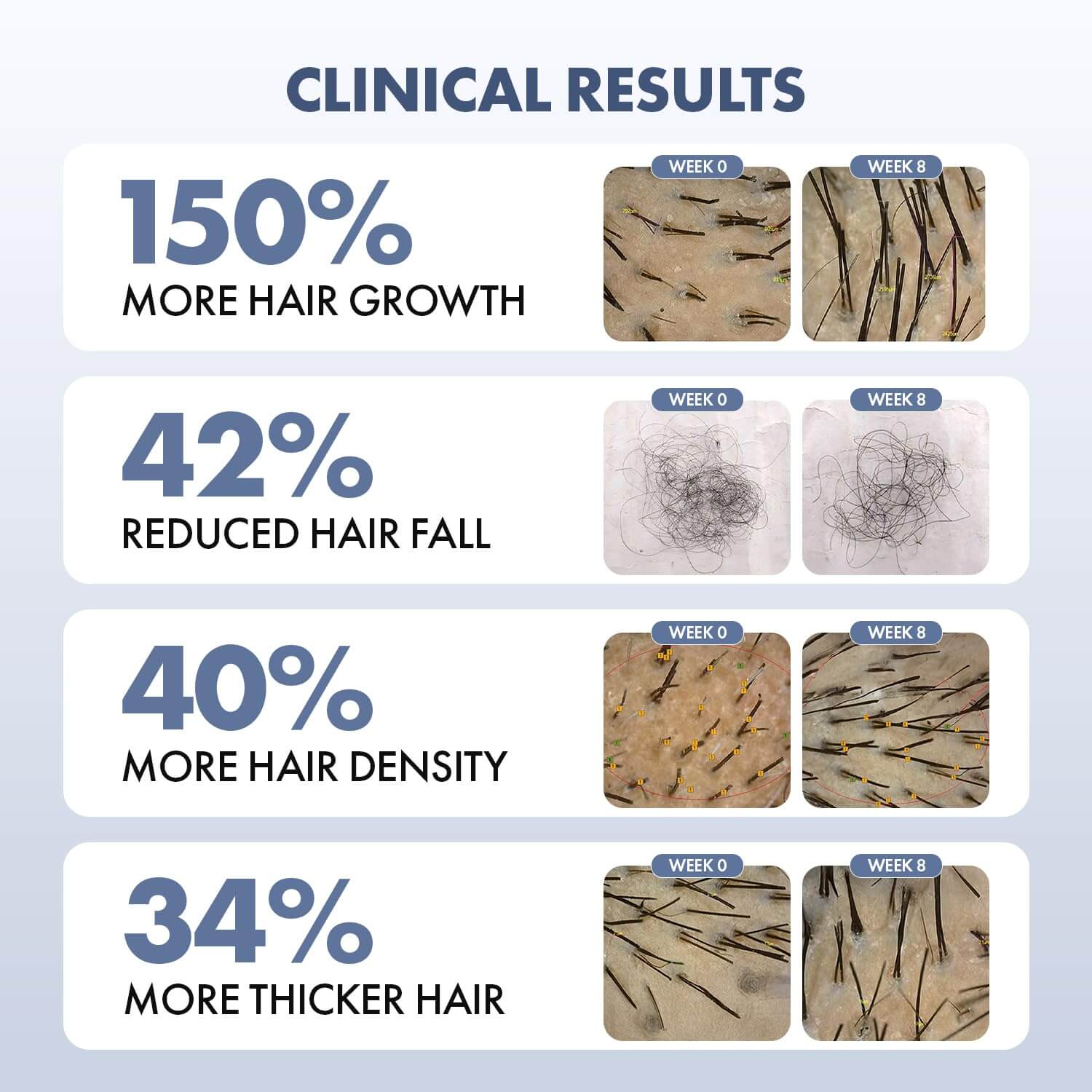 ThriveCo Hair Growth Serum 2.0 – Hairfall Control & Regrowth Scalp Treatment, 50 ml