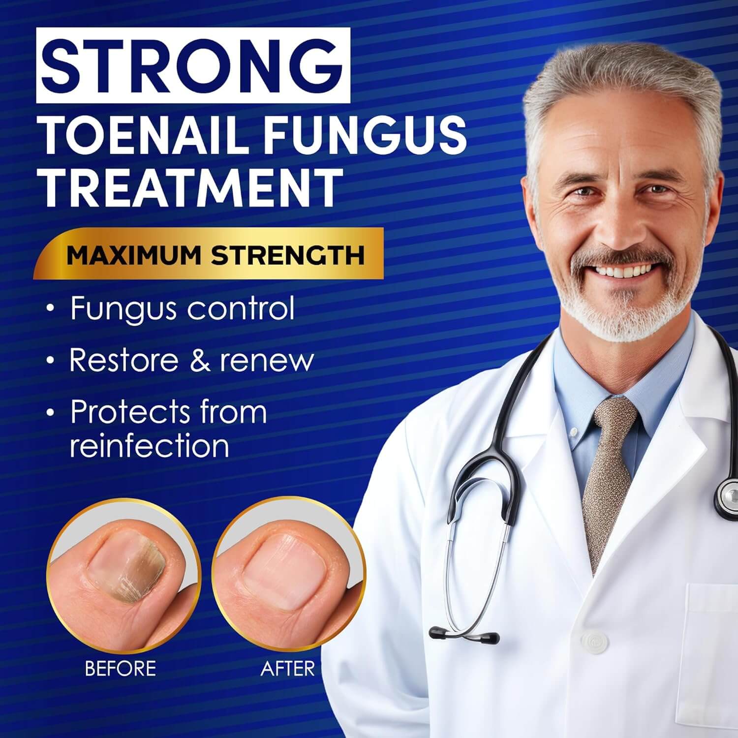 Toenail Fungus Treatment – Extra Strength Antifungal Nail Repair Solution, 1 fl oz